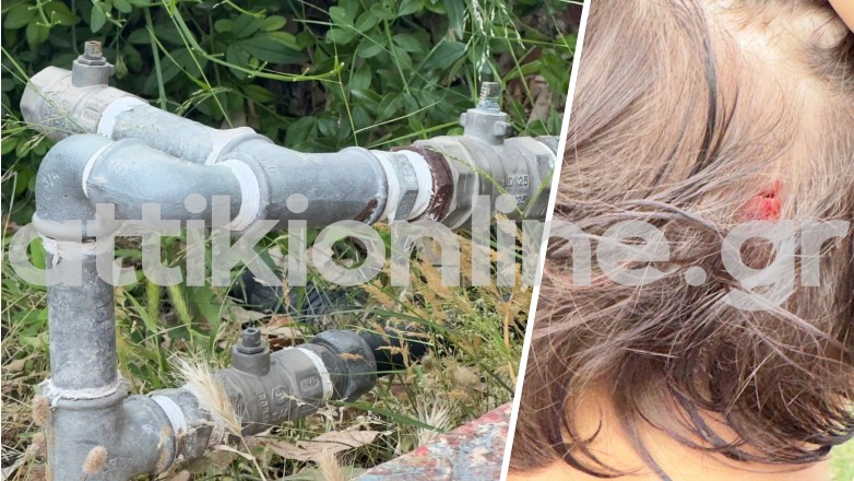 Παιδική χαρά–παγίδα στο Περιστέρι: Τραυματισμός παιδιού από ακάλυπτες σωληνώσεις